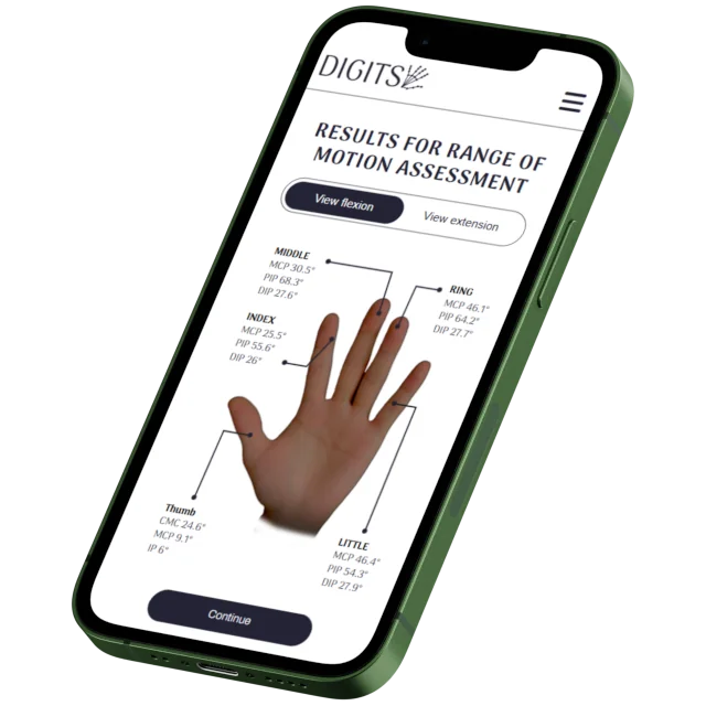 The DIGITS web app running on a phone