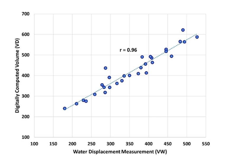Digital hand volume assessment compared to water-displacement volumetry